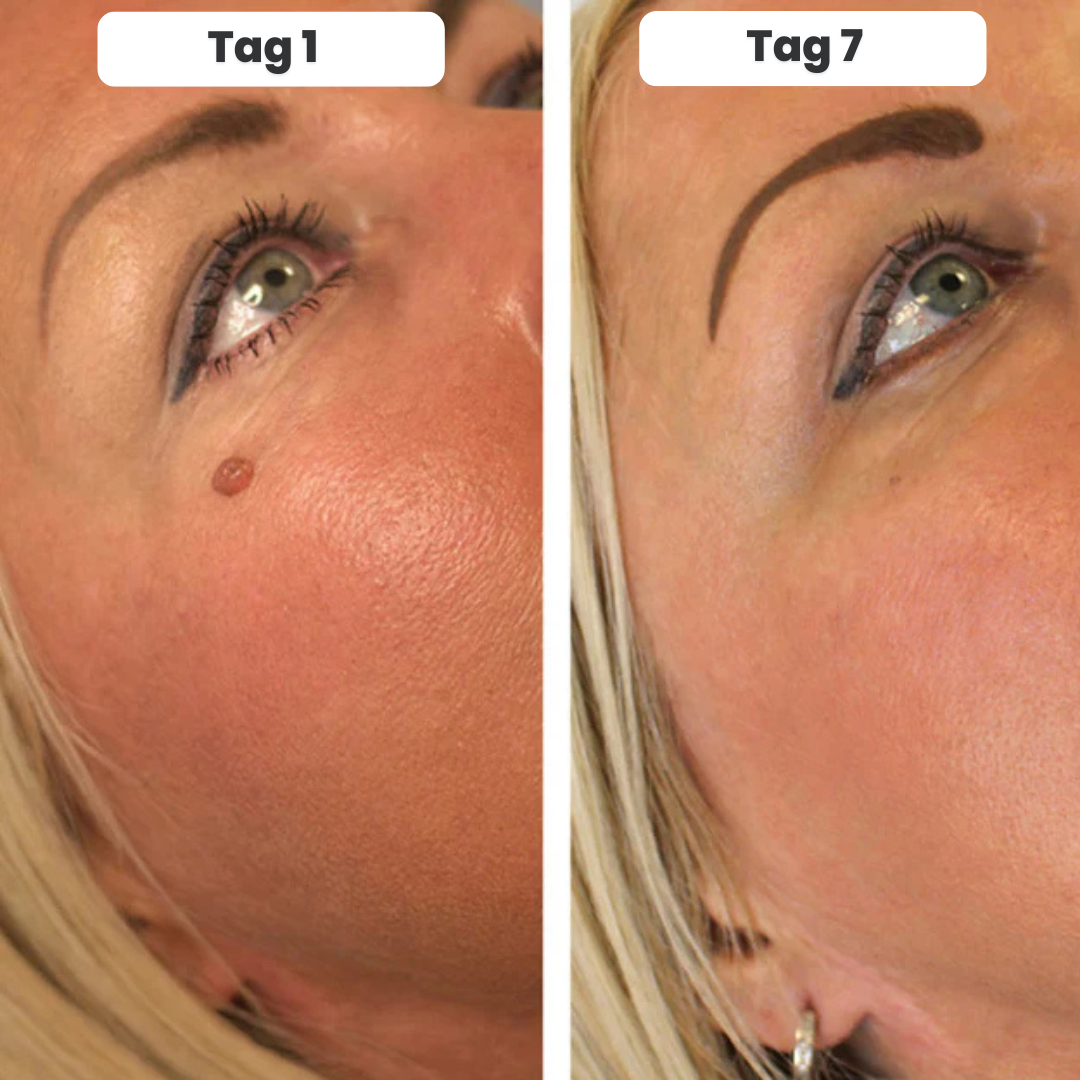 DermaTag