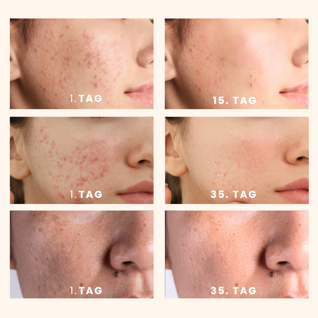 GlowPads Kurkuma – Für reine & strahlende Haut