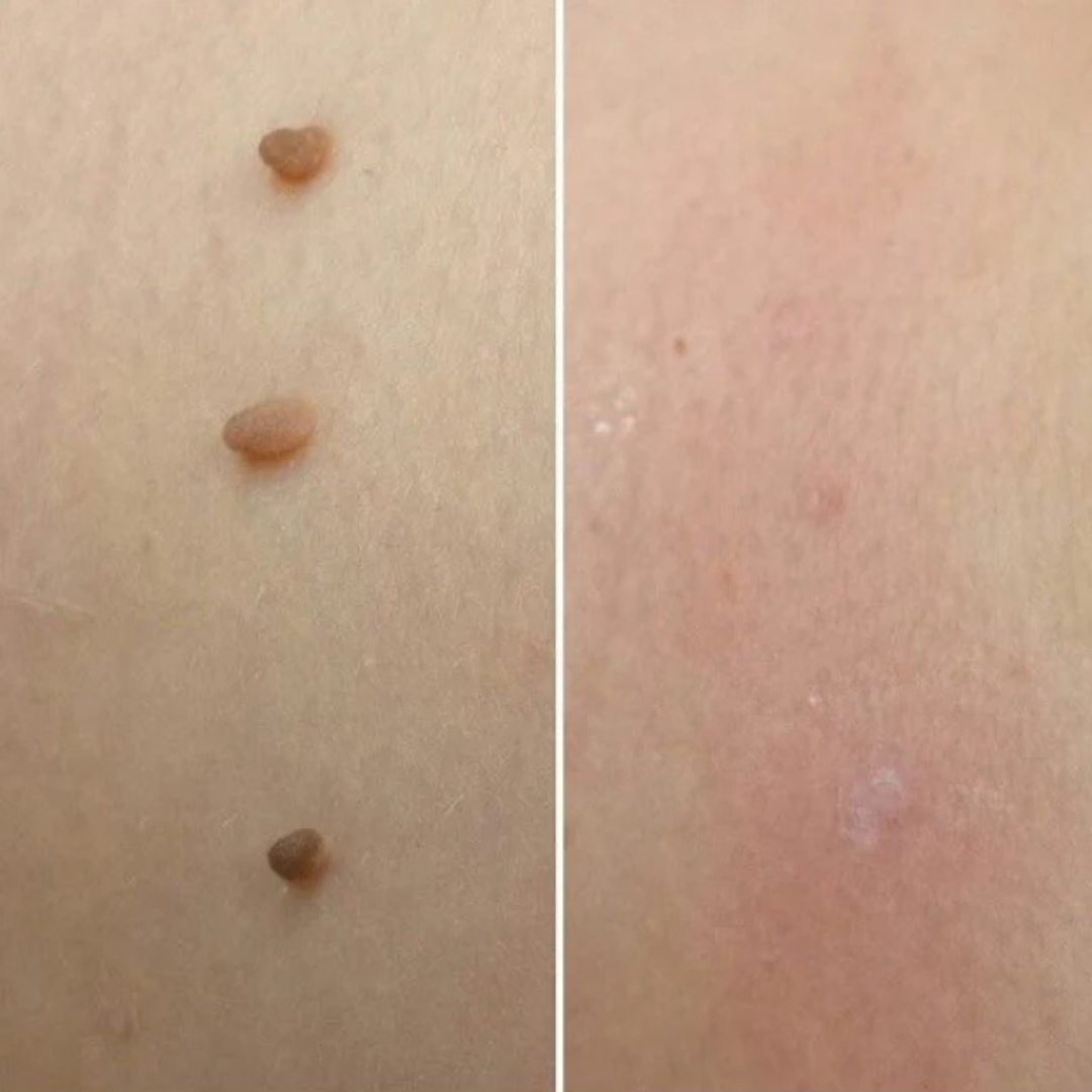 DermaTag