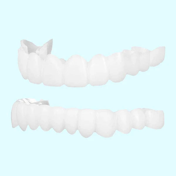 Dentaly™ - Zahnverblendungen