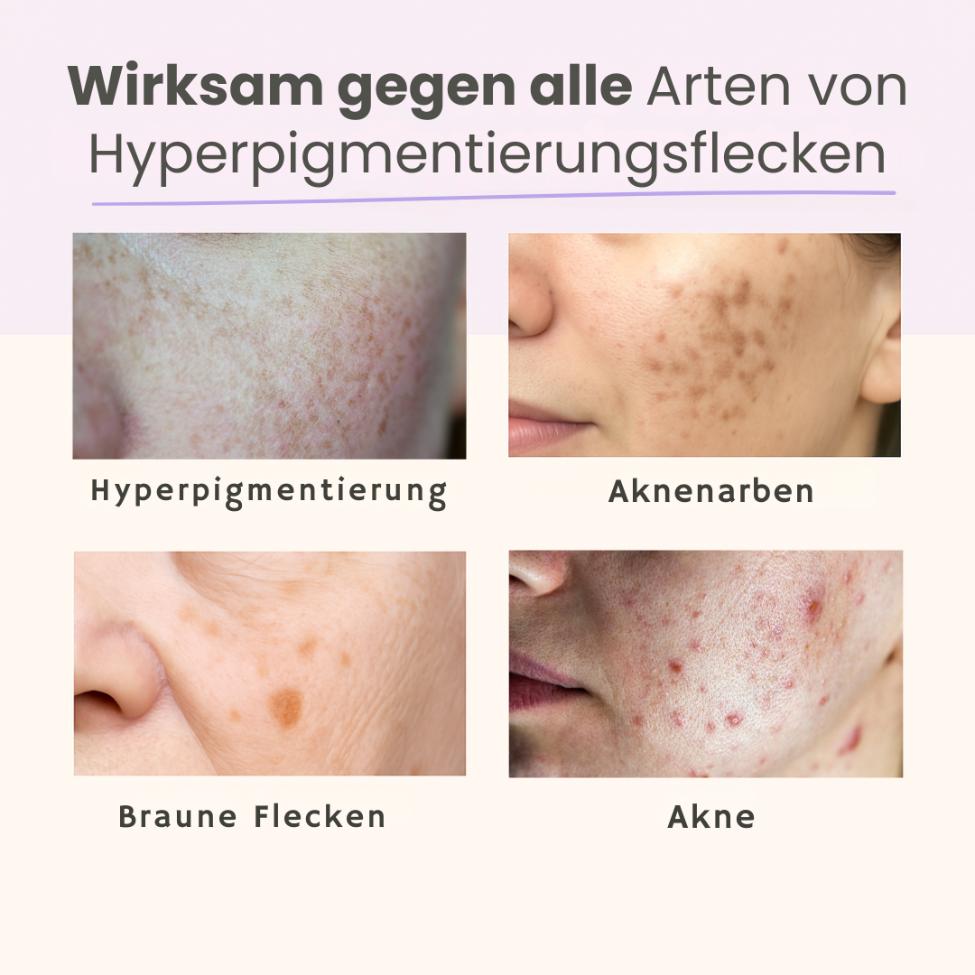 GlowPads Kurkuma – Für reine & strahlende Haut