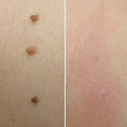 DermaTag