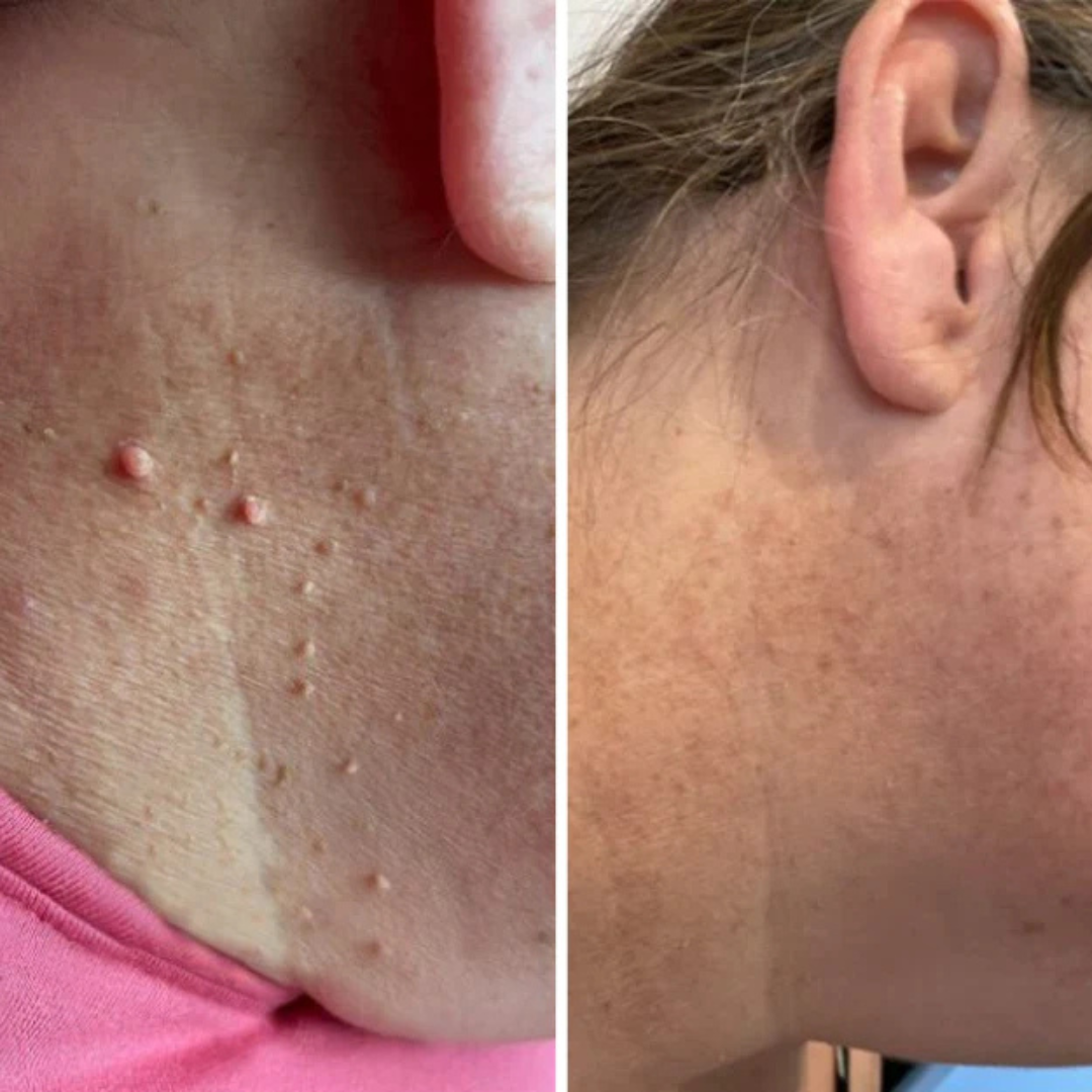 DermaTag