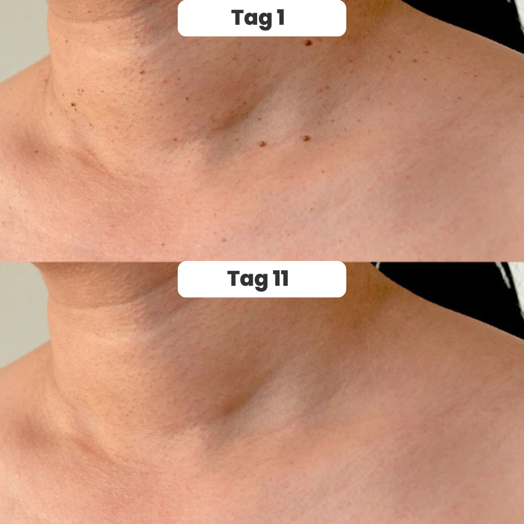 DermaTag