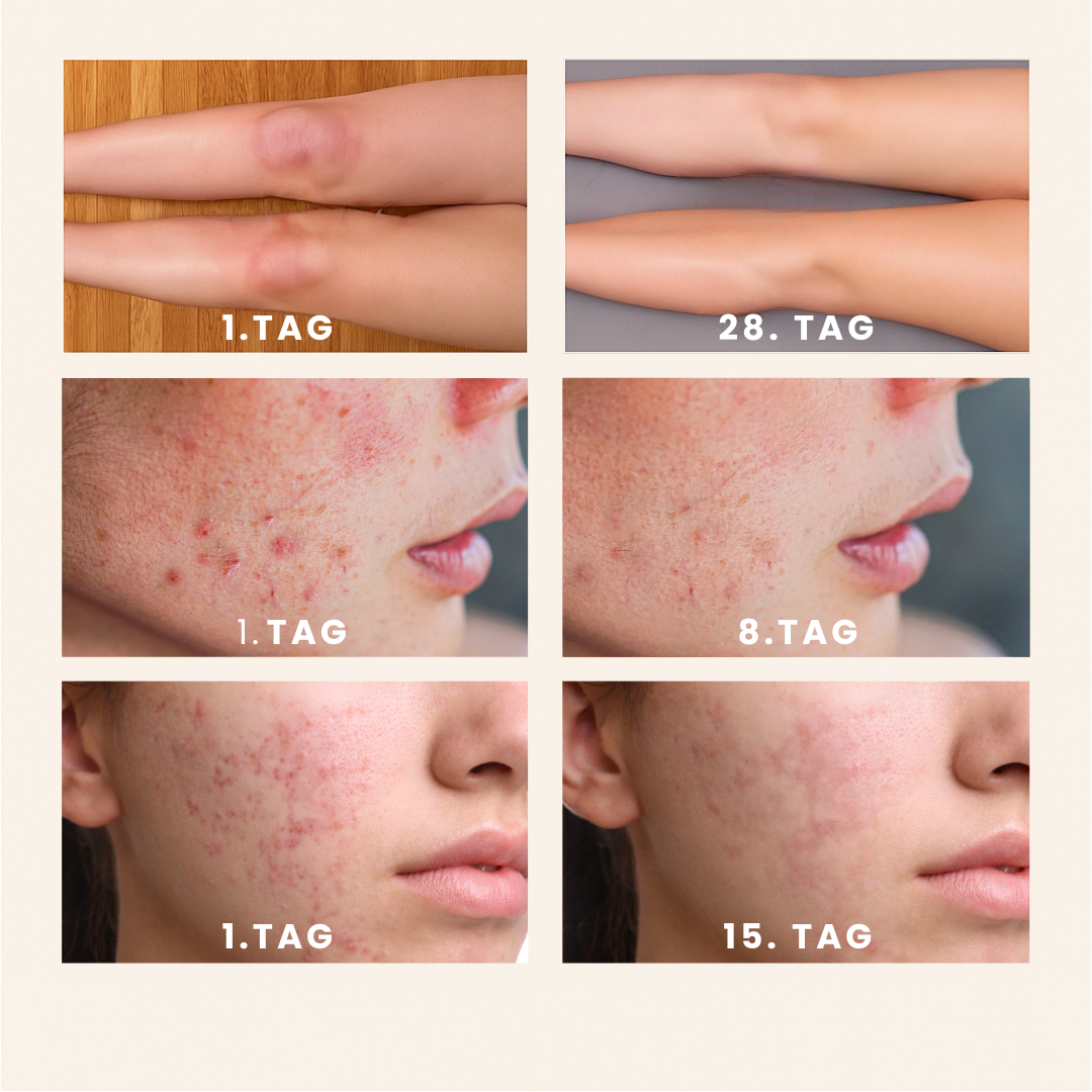 GlowPads Kurkuma – Für reine & strahlende Haut