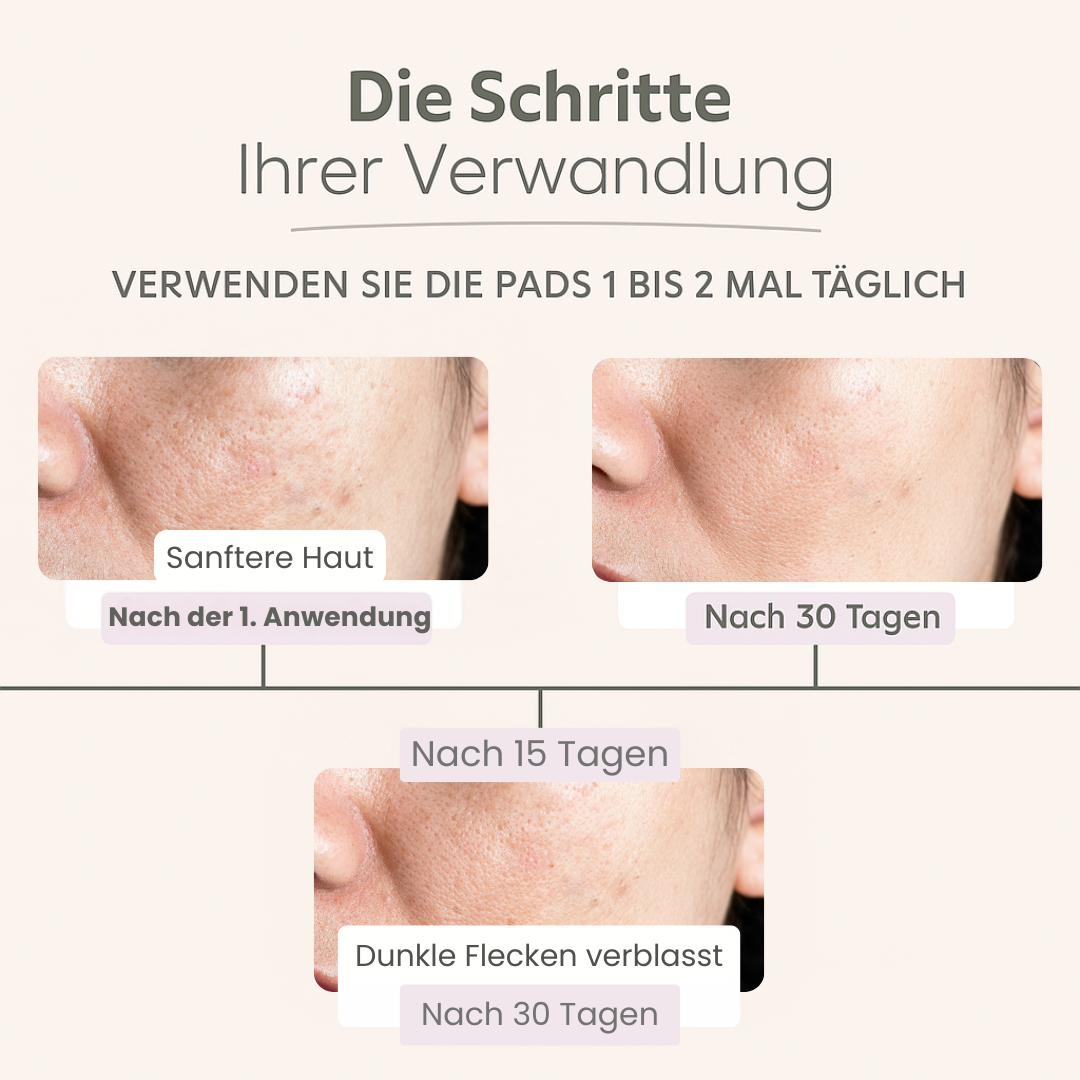 GlowPads Kurkuma – Für reine & strahlende Haut