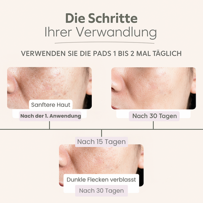 GlowPads Kurkuma – Für reine & strahlende Haut